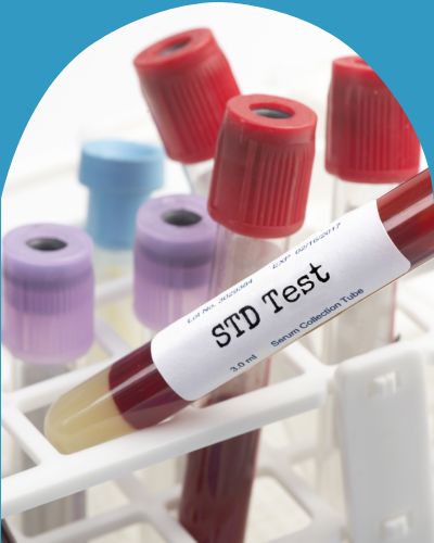 STD Testing in Chicago, IL